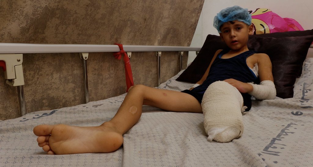 Hunger Drives Amputees to Become Collateral Damage in Gaza