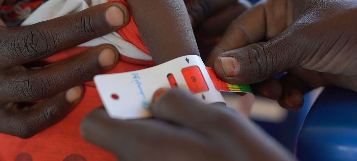 Sudan: UN Alerts to Unprecedented Child Hunger in Darfur Amid Fighting and Refugee Exodus